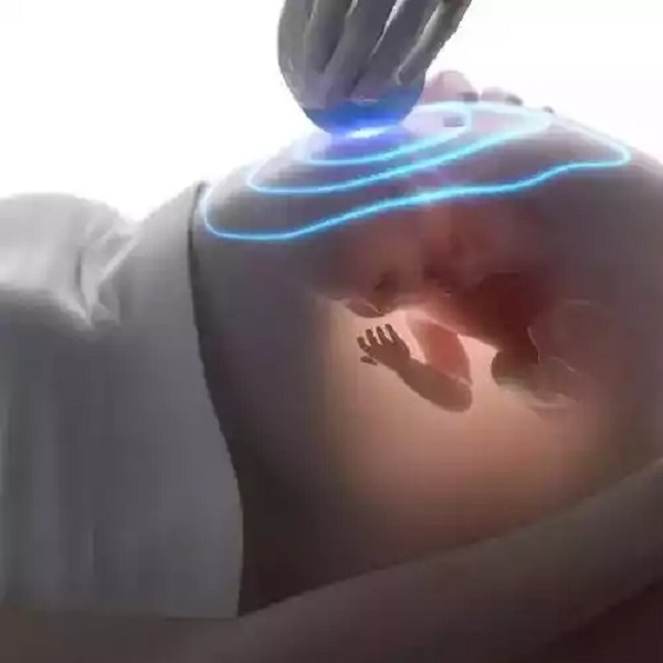 图片说明