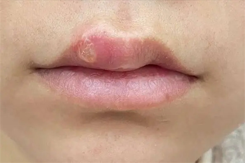 细节描述