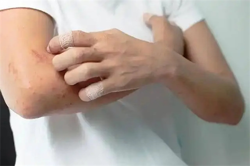 详细说明