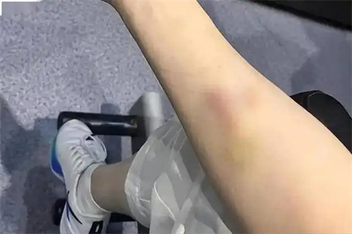 细节介绍