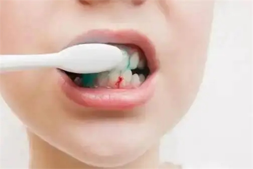 详细介绍