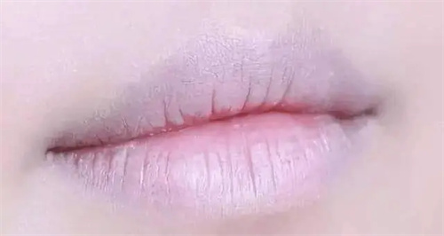 详细说明