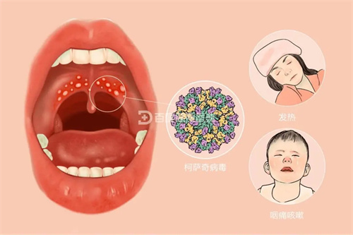 图片细节