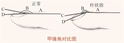 图片细节