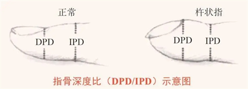 细节介绍