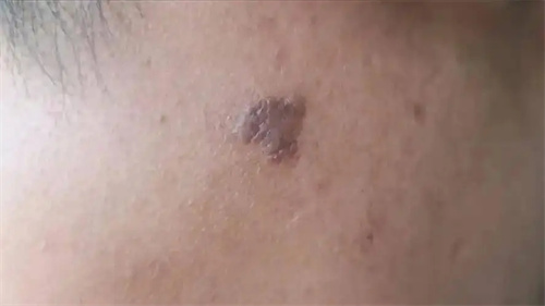 细节介绍