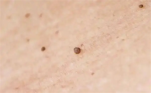 详细说明