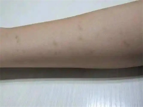 详细介绍