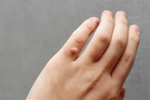 细节说明