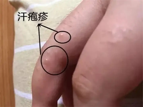 细节介绍