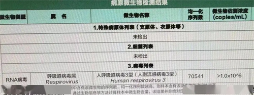 细节说明