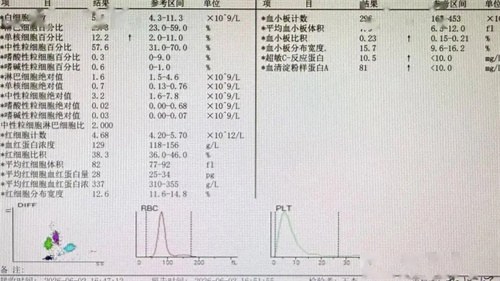 细节介绍