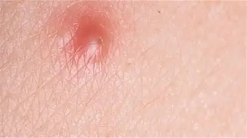 细节说明