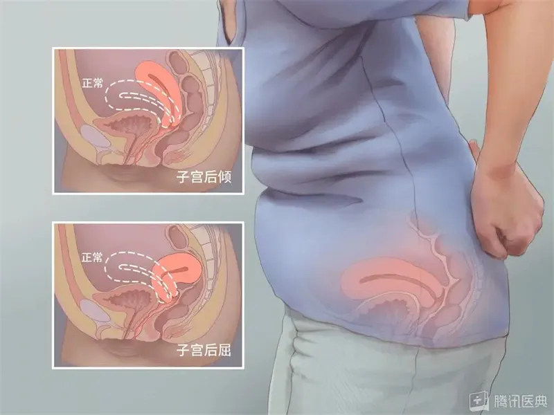 细节介绍